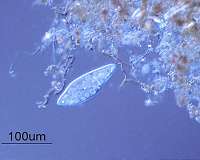 How evolution alters biological invasions