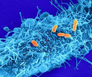 When Good Food Goes Bad: Strengthening the US Response to Foodborne Disease Outbreak