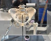 Magnesium may protect against hip fractures