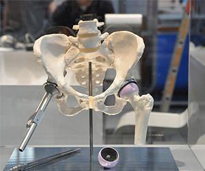 Southampton engineers develop novel method to increase lifespan of joint replacements