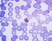 New plant engineering technique could aid fight against malaria