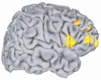 Imaging Study Illustrates How Memories Change In The Brain Over Time