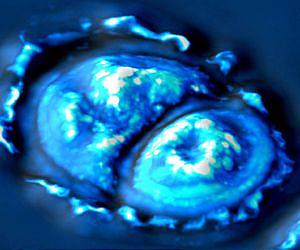 New imaging method sheds light on cell growth