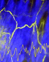 Cornell Licenses 3-D Micro-Imaging Technology To Zeiss