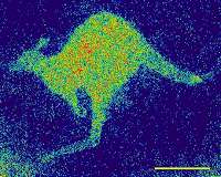 Aussie quantum tech has its sights set on human biochemistry