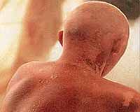 Agent Protects Cells From Lethal Effects Of Radiation Even If Given After Exposure