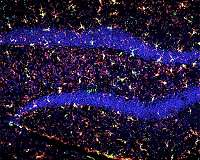 Deep space radiation treatment reboots brain's immune system