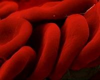 Marines use freeze-dried plasma to save foreign ally