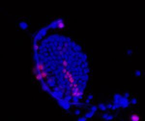Study Shows How One Insect Got Its Wings