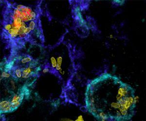 Typhoid Fever - A race against time