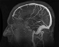 Engineering a protein to prevent brain damage from toxic agents