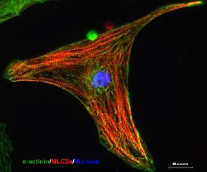 New stem cell technique promises abundance of key heart cells