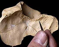 Most Ancient Case Of Tuberculosis Found In 500,000-Year-Old Human; Points To Modern Health Issues
