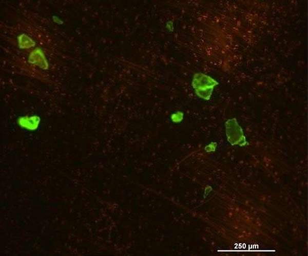 Assessing microplastic contamination in marine plankton to mitigate global pollution