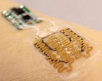 Smart bandages designed to monitor and tailor treatment for chronic wounds