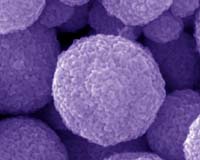 Popcorn-Ball Design Doubles Efficiency Of Dye-Sensitized Solar Cells