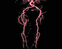 Microbot Motors Fit To Swim Human Arteries