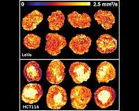 Technology used to map Mars now measuring effect of treatment on tumors