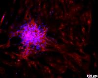 'Hydrogels' boost ability of stem cells to restore eyesight and heal brains