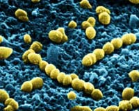 Astronauts To Conduct Study Of Bacterial Growth In Space