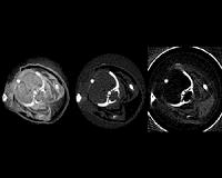 Compact synchrotron makes tumors visible