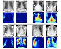 Training artificial intelligence with artificial X-rays