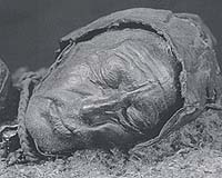 Build me a face in 3D: British man's life 'transformed'