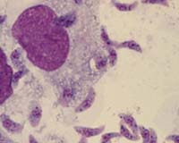 Cat Parasite May Affect Cultural Traits In Human Populations