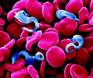 Do parasites upset food web theory?