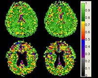 Cell density remains constant as brain shrinks with age