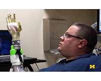 'It's like you have a hand again': An ultra-precise mind-controlled prosthetic