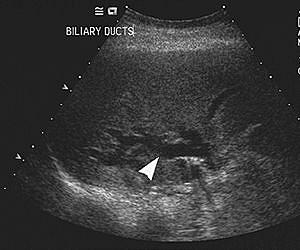 Texas A and M research contributes to improved ultrasound imaging