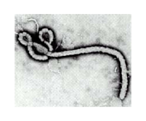 Experimental Treatment Protects Monkeys From Lethal Ebola Virus Post-Exposure