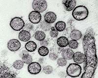 Colorado Team Developing Flu Chip For Fast, Accurate Diagnosis