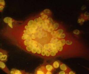 Early Detection of Immune Changes Prevents Painful Shingles in Astronauts and Earth-Bound Patients4