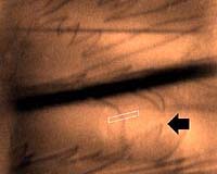 Breaking the Nanometer Barrier In X-ray Microscopy