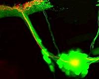 Bright prospects: Repairing neurons with light
